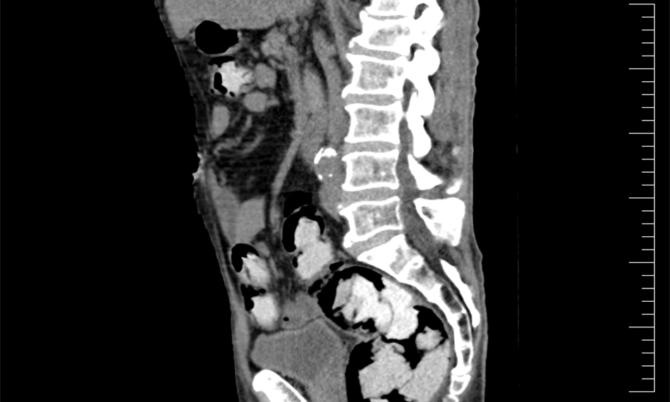 2017-10-4-947foto 1.png